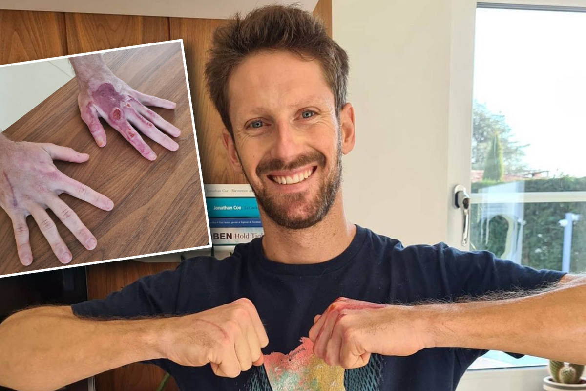 Romain Grosjean zeigt linke Hand ohne Verband; Credit: Grosjean/Instagram